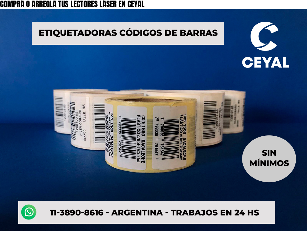 COMPRÁ O ARREGLÁ TUS LECTORES LÁSER EN CEYAL